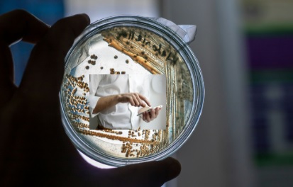 A Petri dish containing bacterial growth. An individual's hand is visible in the centre scrolling on a phone.